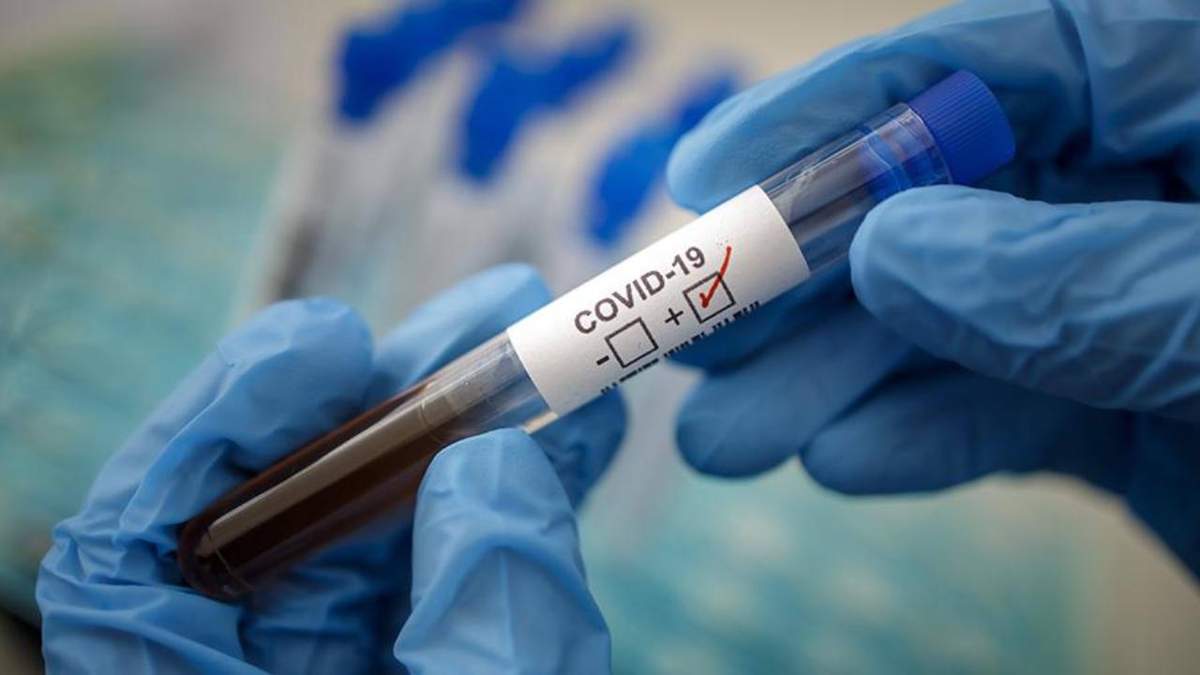 В Киеве в 24 общежитиях зафиксировали COVID-19 В Киеве в 24 общежитиях зафиксировали COVID-19